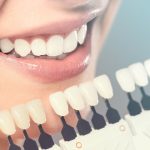 Cosmetic Dentist in Beverly Hills, California – Schedule a checkup today!