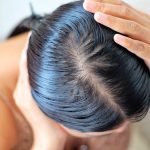3 Simple Methods To Reduce Sebum on Your Scalp