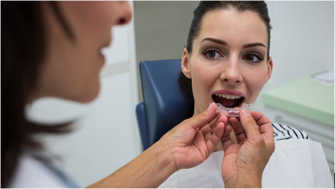 Invisalign